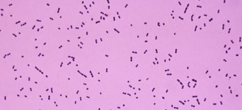 streptococcuspneumoniae